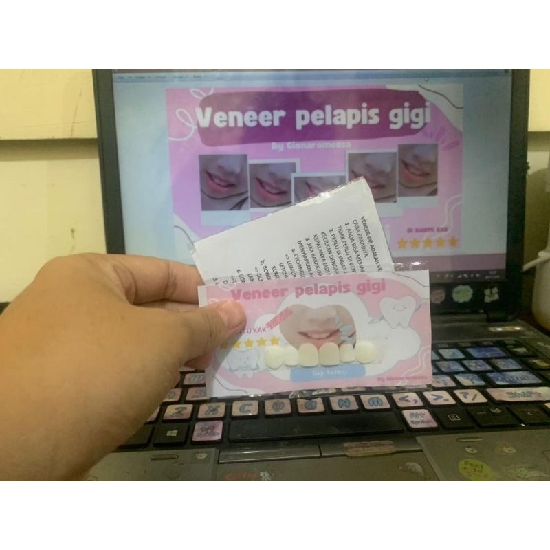 veneer pelapis gigi kelinci pelapis super elastik di duni