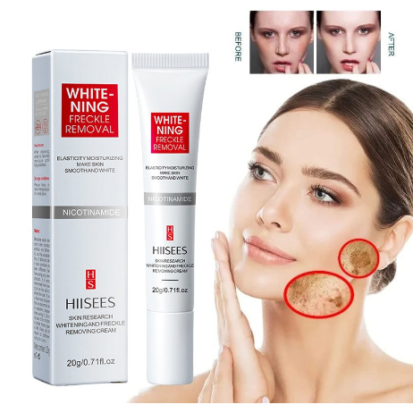 Hiisees Cream Anti Flek Hitam Mencerahkan Wajah Menghilangkan Bintik Bintik Hitam Di Wajah