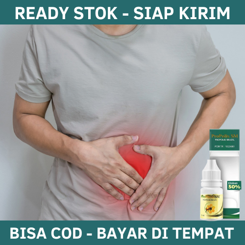 Obat Hernia, Obat Hernia Turun Berok, Obat Turun Berok Pria, Obat Turun Berok Wanita, varikokel, Bua