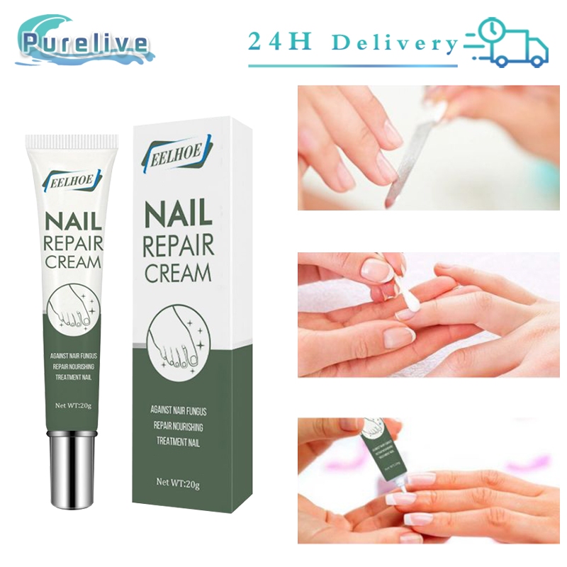 20g Obat Jamur Kuku Kaki Eelhoe Nail Repair Cream Obat Cantengan Jempol Kaki