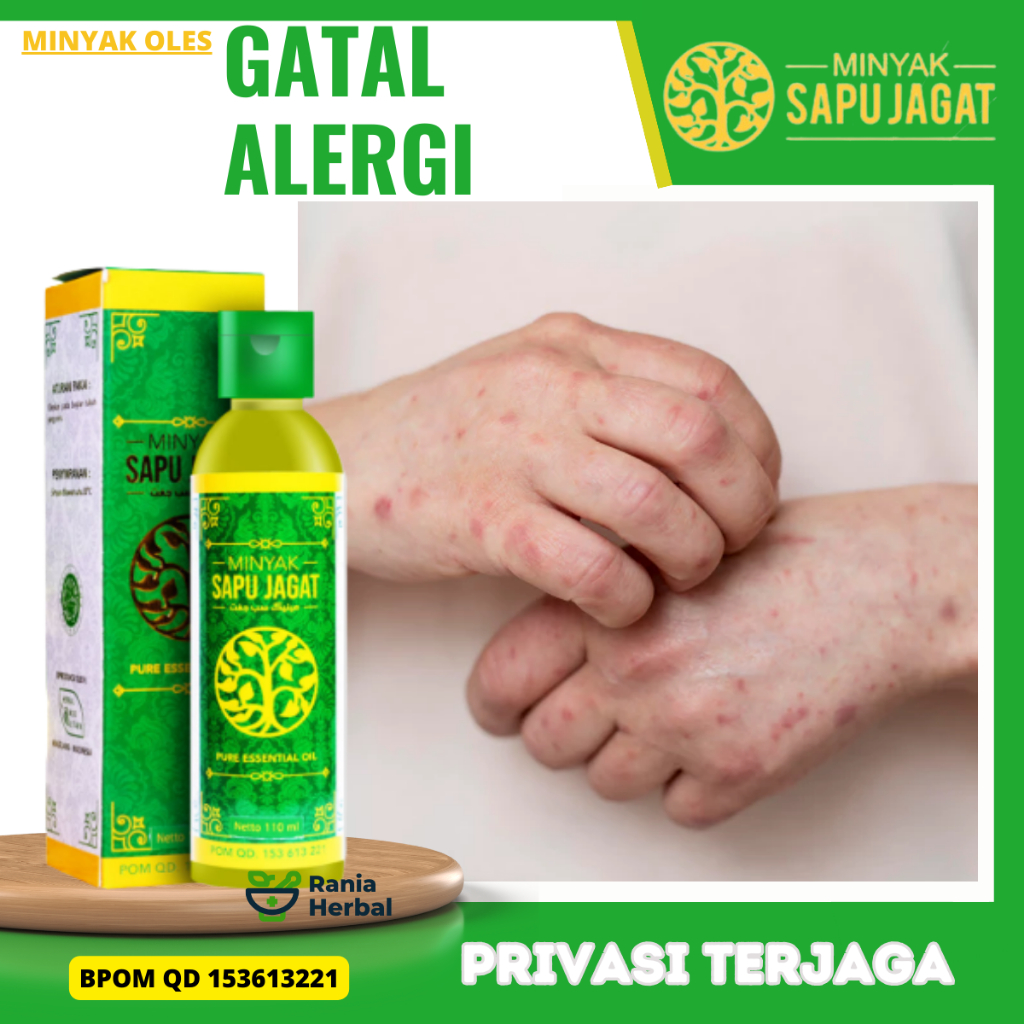 Obat Kulit Gatal Alergi, Obat Gatal Alergi Makanan, Obat Gatal Alergi Dingin, Obat Gatal Seluruh Bad