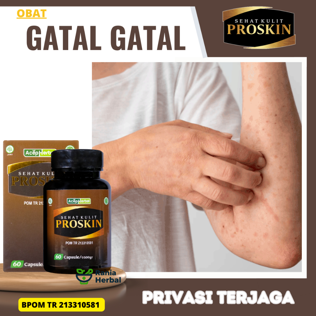 Obat Kulit Gatal, Obat Gatal Seluruh Badan, Obat Gatal Berjamur, Obat Gatal Alergi, Obat Gatal Menle