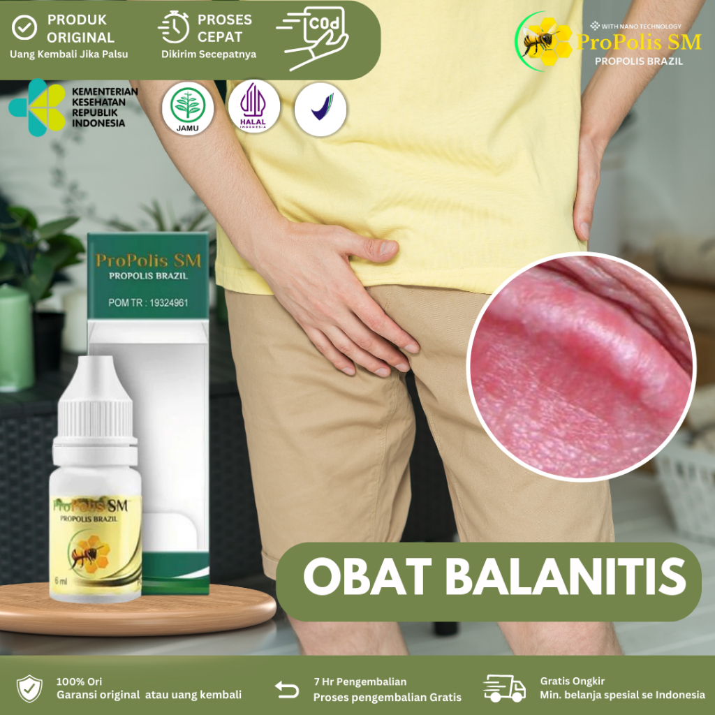 Obat Balanitis, Obat Ruam dan Gatal MR.P Obat Luka Lecet di Kepala Penis Bengkak Gatal Kemaluan Pria