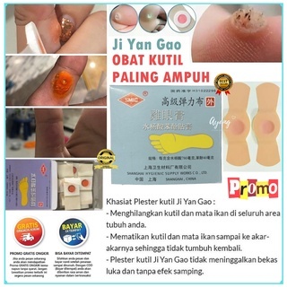 PENGHILANG MATA IKAN KUTIL PLESTER KAPALAN AMPUH OBAT MENGHILANGKAN BEKAS LUKA JI YAN GAO HERBAL ORI