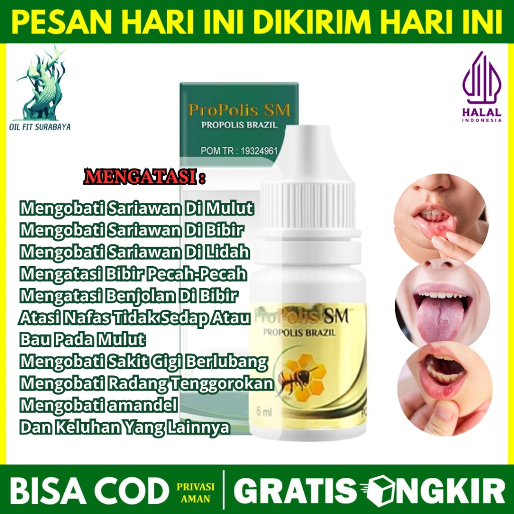 Obat Sariawan Akut - Sariawan Parah - Sariawan Berdarah - Sariawan Radang - Sariawan Menahun Agar Ce