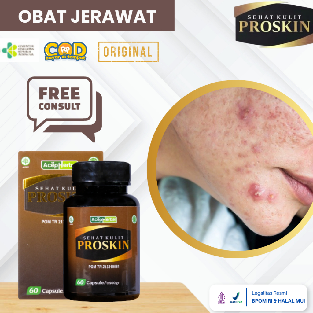 Obat Jerawat, Obat Jerawat Dan Bekas Jerawat, Obat Jerawat Bernanah, Obat Jerawat Batu, Obat Bruntus