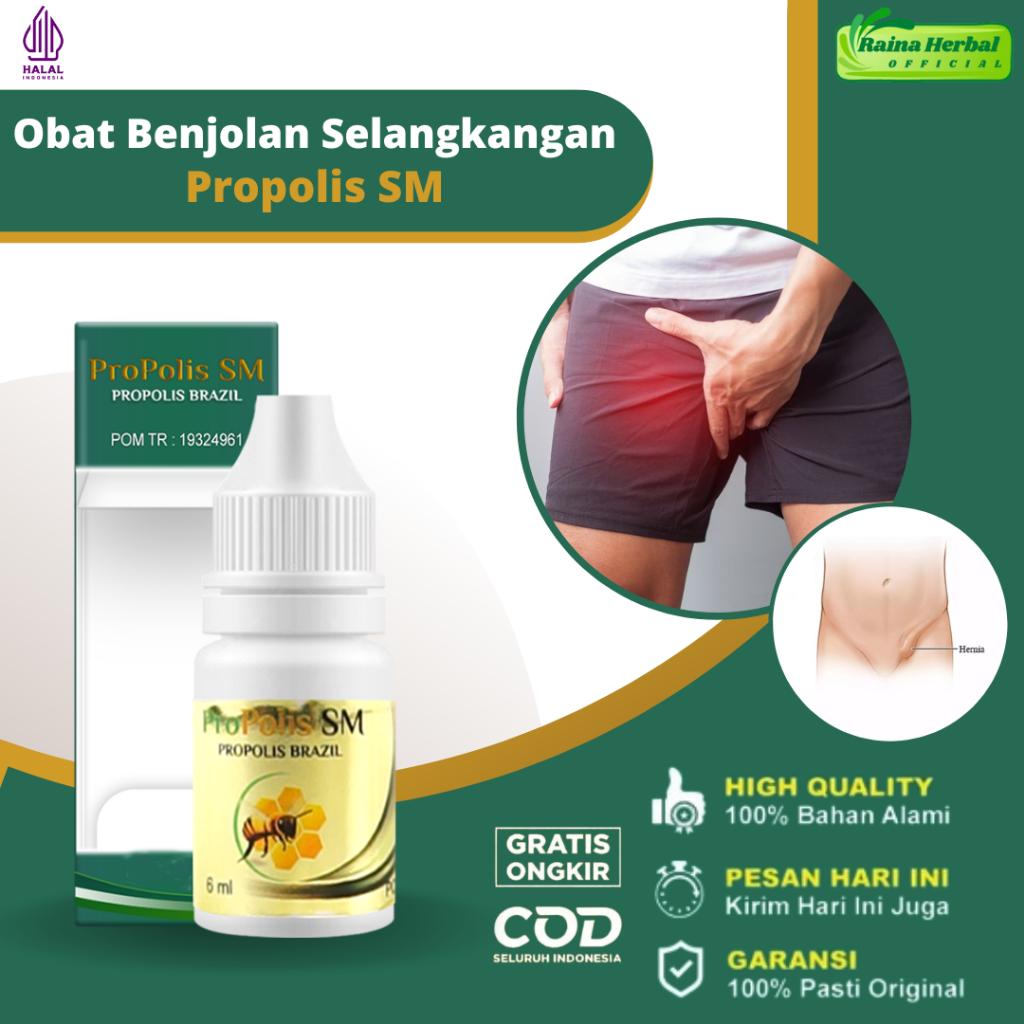Obat Benjolan Di Selangkangan Pria Wanita Herbal Penghancur Benjolan Selangkangan Sekelan Kelenjar G