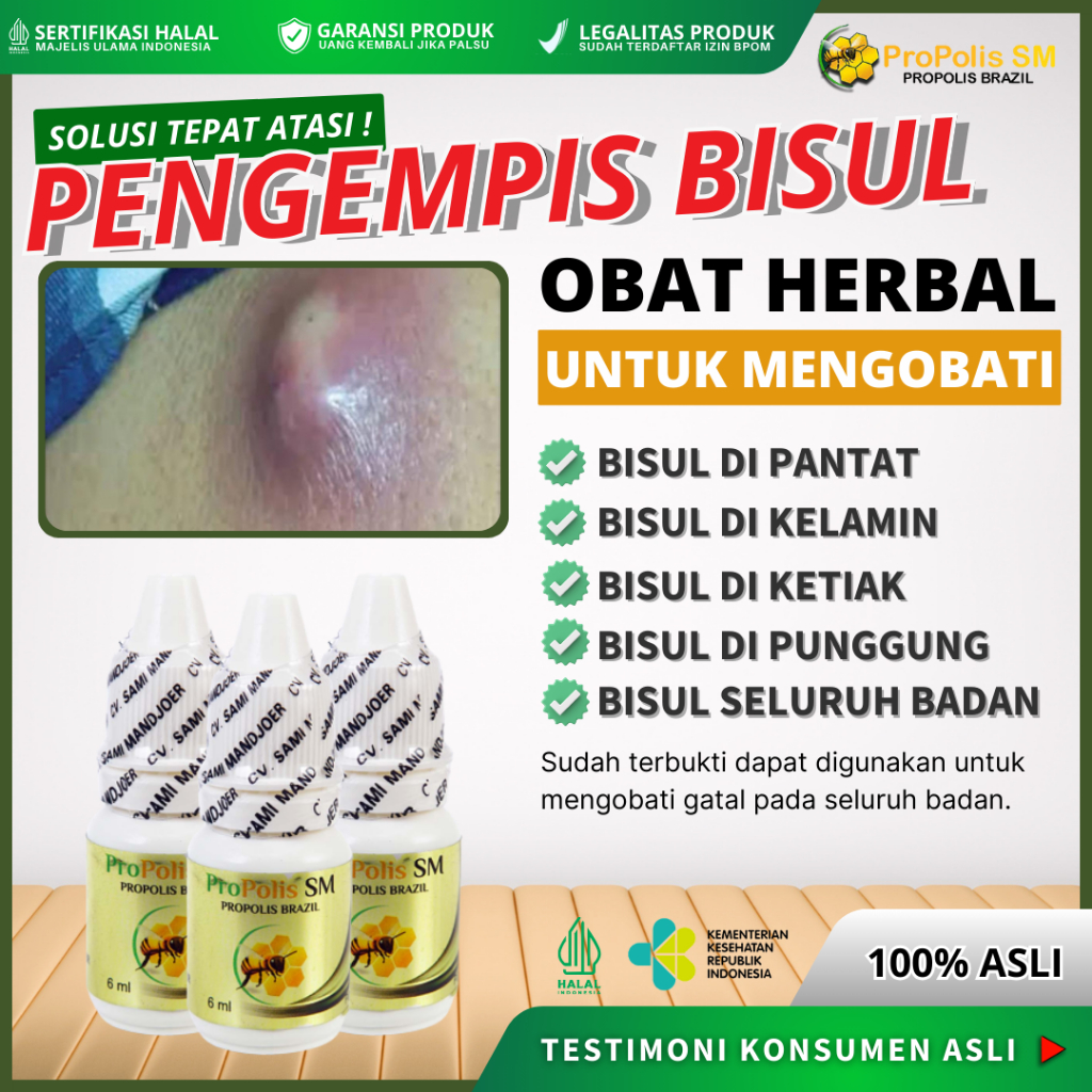 Obat Herbal Pengempis Bisul, Penghilang Bisul, Perontok Bisul, Penjinak Bisul, Bisul Di Pantat, Bisu