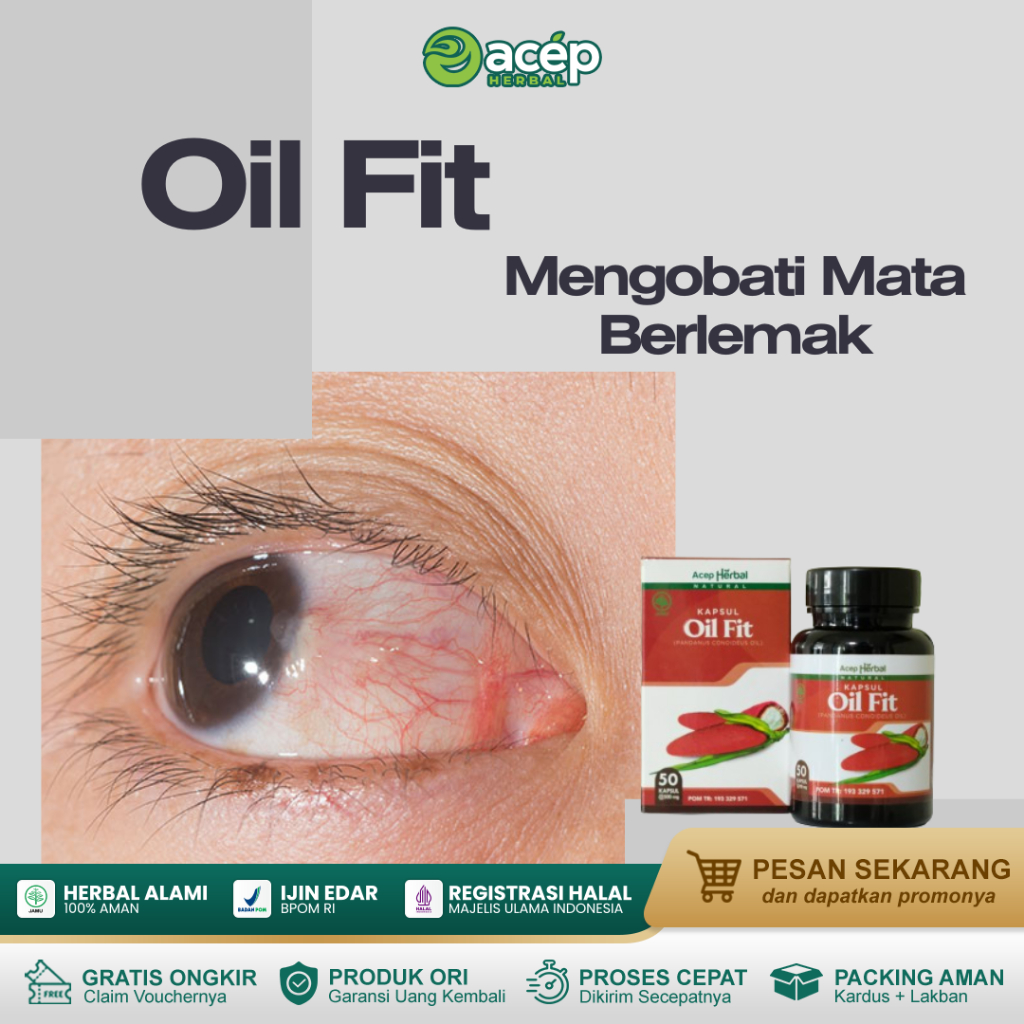 Oil Fit Untuk Mengobati Mata Berlemak
