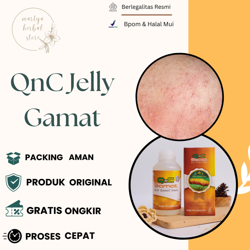 Obat Gatal, Obat gatal Kulit, Obat Alergi Gatal, Obat Gatal Selangkangan, Obat Gatal Berair Menyebar