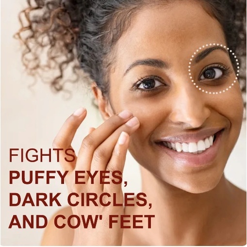 Original AUQUEST 30Gr Cream Memudarkan lingkar hitam Kantong Mata Bengkak