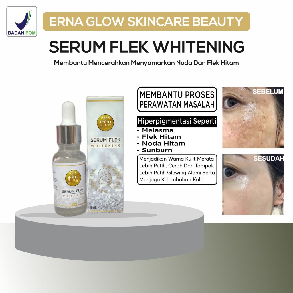 Serum  Ampuh Hilangkan Melasma, ERNA GLOW  Skincare Beauty Erna serum flek whitening