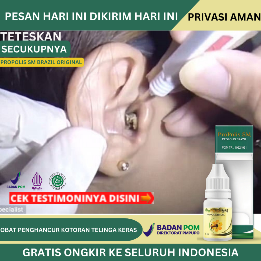 Obat Tetes Penghancur Kotoran Telinga Keras, Pelunak Kotoran Telinga Yang Keras, Kotoran Telinga Men