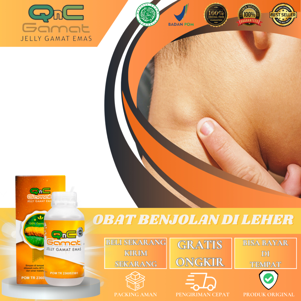 Obat Benjolan Di leher Obat Uci Uci Obat Benjolan Kelenjar Getah Bening Obat Benjolan Lipoma Obat Ny