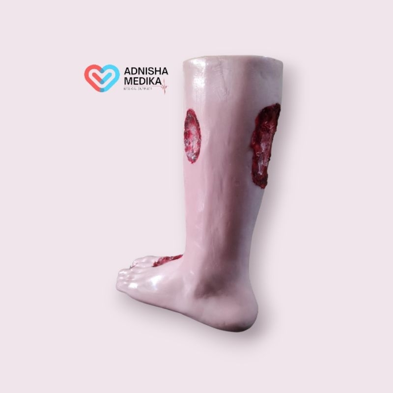 PHANTOM MANIKIN MODEL KAKI LUKA / MANEKIN MODEL KAKI LUKA