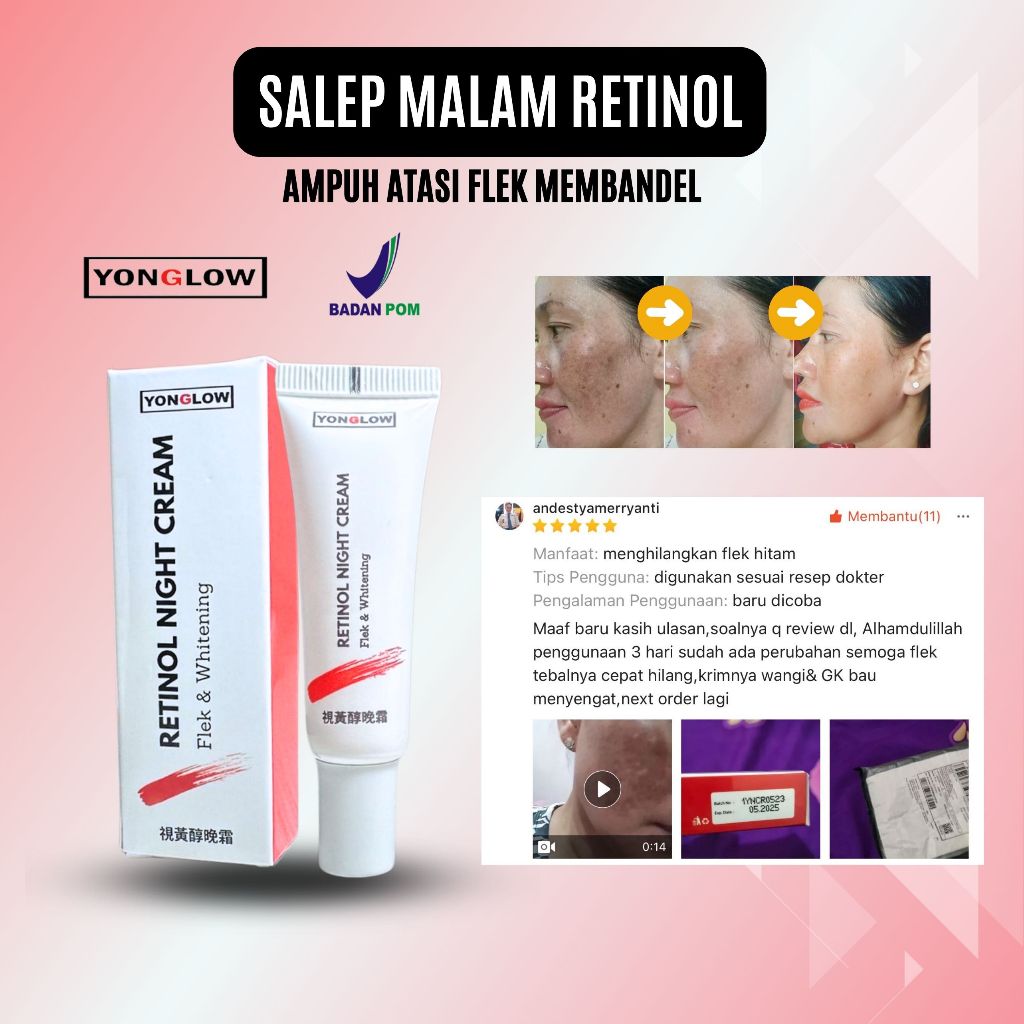 Salep Cina Flek BPOM Yonglow Skincare Salep Malam Flek Noda Hitam Bintik Melasma Wajah Cream Anti Ag