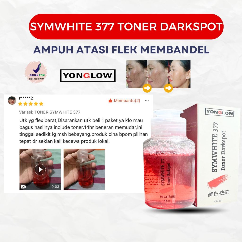 BPOM Symwhite 377 Darkspot Toner Yonglow Toner Penghilang Flek Hitam Melasma Hiperpigmentasi Ampuh P