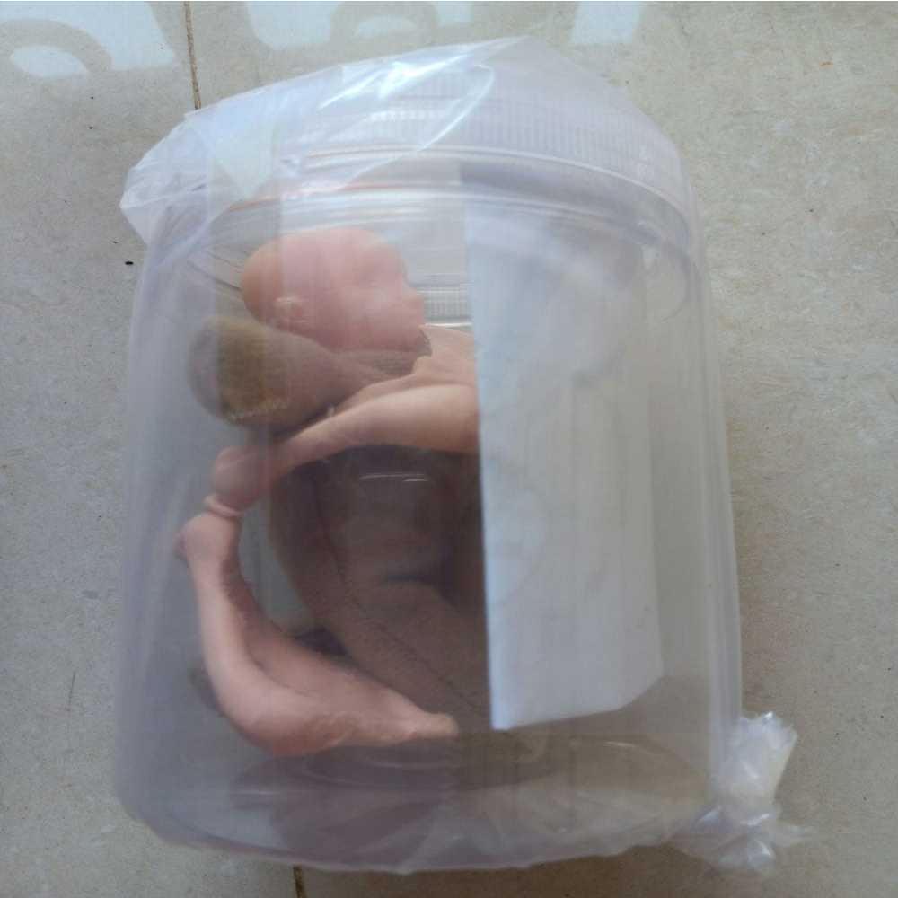 Phantom Panggul Mekanisme Persalinan