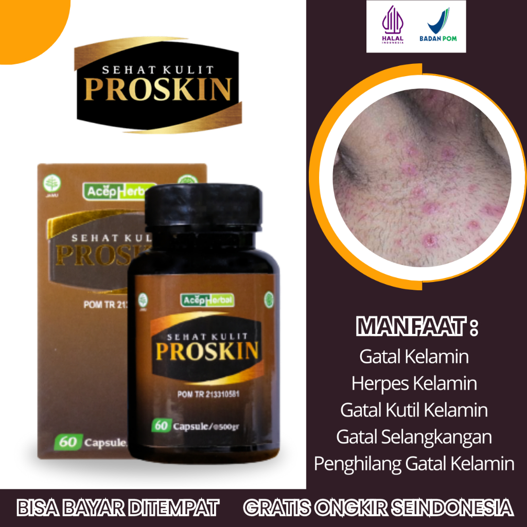 Obat Gatal Kelamin, Obat Herpes Kelamin, Obat Kutil Kelamin, Obat Kutil HPV, Obat Eksim Kelamin, Oba