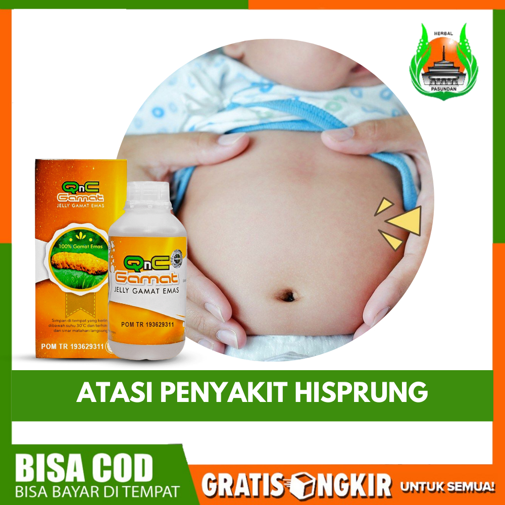 Obat Herbal Penyakit Hisprung (Hirschsprung), Sembelit Berkepanjangan Anak & Dewasa Perut Kembung Ke