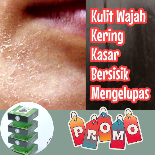 Obat Kulit Kering Bersisik, Kulit Kering Pecah pecah, Kulit Kering Mengelupas, Kulit Kering dan Gata