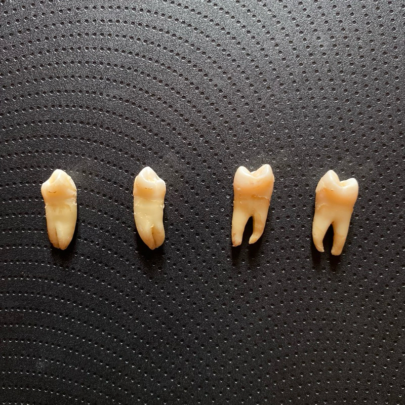 4 GIGI DEWASA ASLI UNTUK PRAKTEK FKG (premolar atas dan bawah non karies)