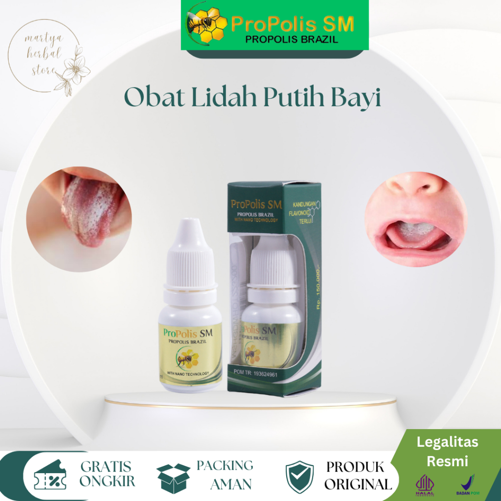 Obat Herbal Lidah Putih Bayi, Obat Sariawan Lidah, Obat Jamur Lidah Pada Bayi, Obat Tetes Lidah Puti