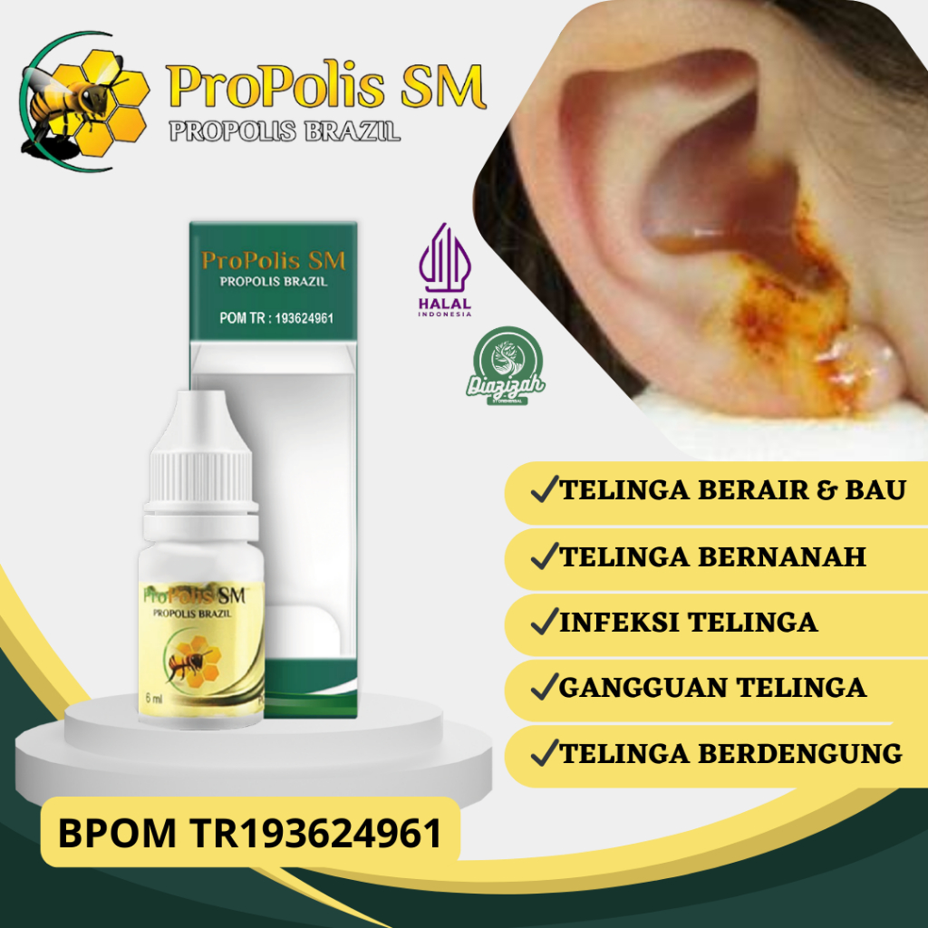 Obat Tetes Telinga Gatal, Obat Telinga Berair, Obat Telinga Berdengung, Obat Infeksi Telinga, Obat T