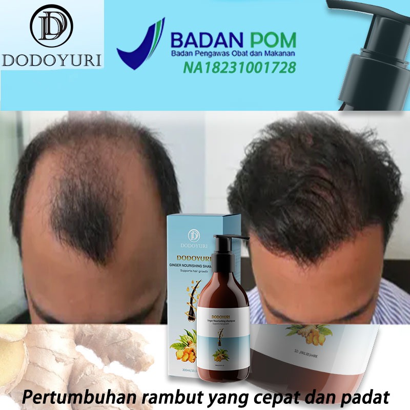 [BPOM] Sampo penumbuh rambut cepat penumbuh rambut cepat sampo anti ketombe 300ml Shampo Jahe shampo