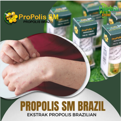 Obat penghilang gatal seluruh badan, jamur kulit, alergi kulit, salep Tetes Cair, penyakit kulit, bi