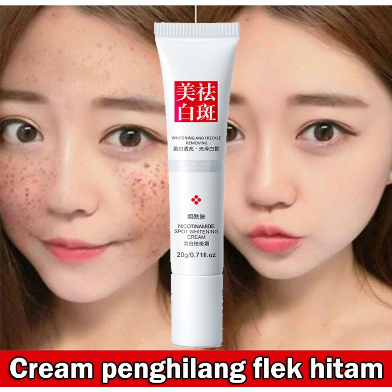 YZKMSKIN - CINDYNAL Whitening  Remove s / Cream Penghilang  Bekas Jerawat & Melasma Pigmen