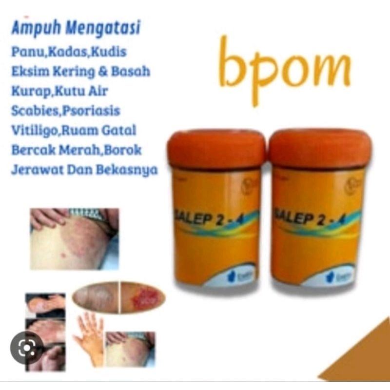 Salep 24 Nufarindo Ampuh Mengatasi Jamur Kulit Panu Kadas Kurap Kutu Air Psoriasis Scabies