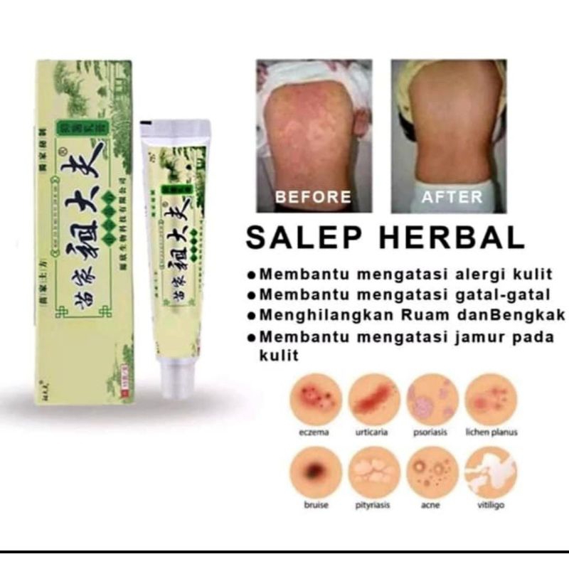 SALEP HERBAL ZUDAIFU