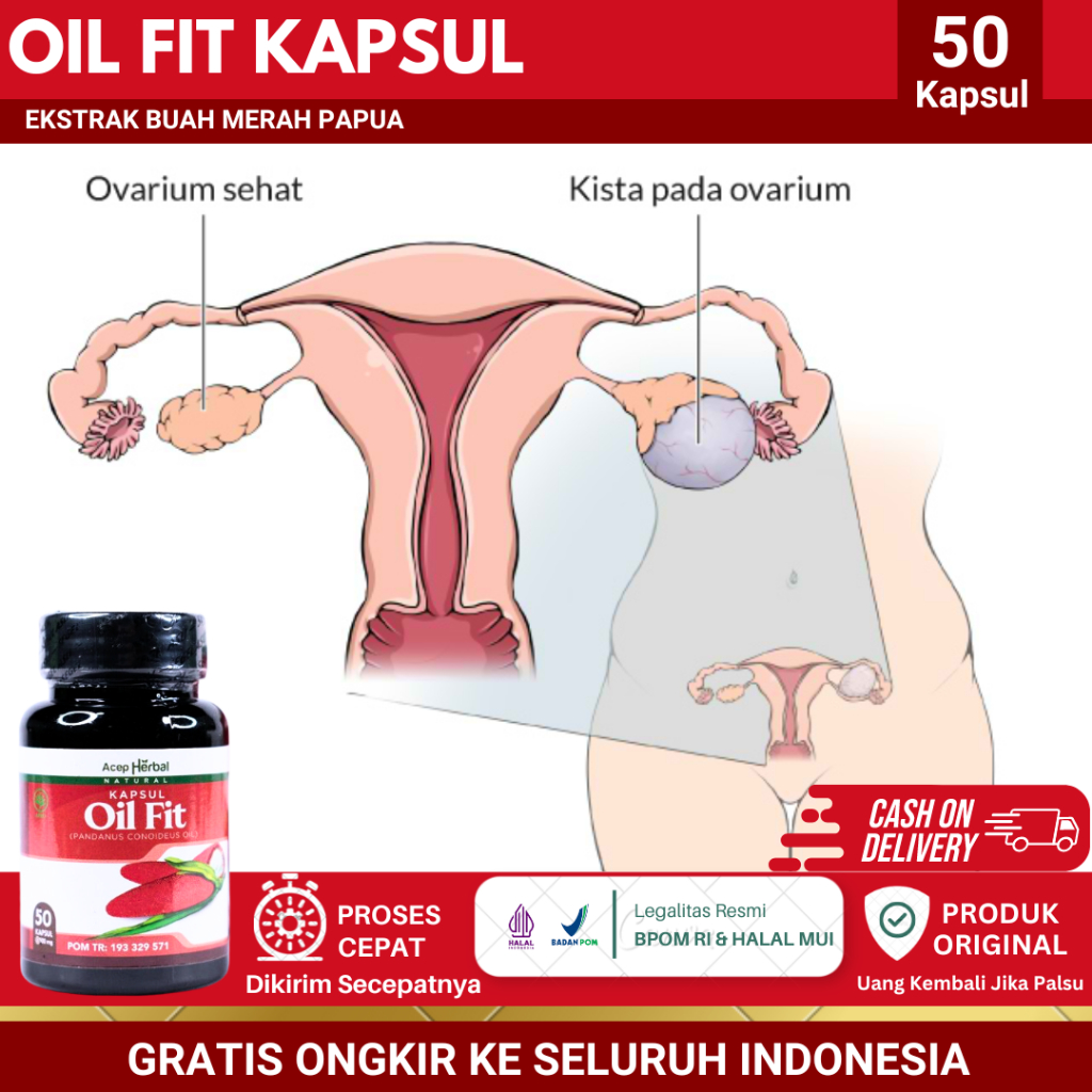 Oil Fit Kapsul - Obat Kista Ovarium, Kista Bartholin, Endometriosis, Kista Ganglion, Kista Miom, Kis