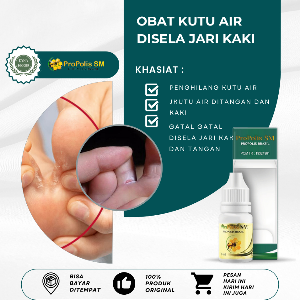 Obat Gatal di Sela Jari Kaki dan Tangan, Obat Kutu Air Gatal Di Sela-Sela Jari, Obat Kutu Air Pada K
