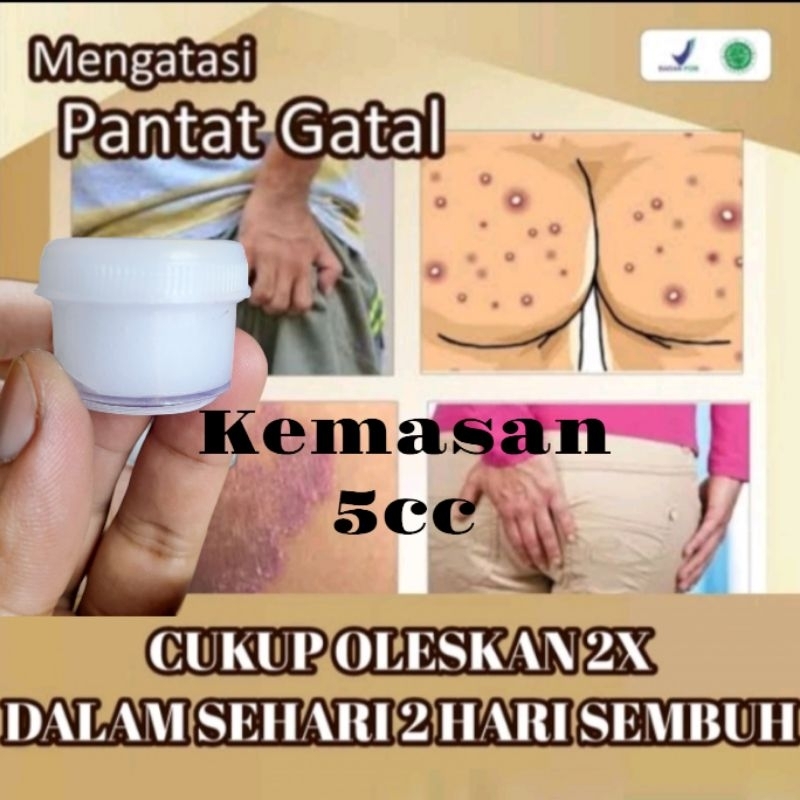 Salep Gatal Racikan Spesialis Kulit untuk Gatal Bokong kemasan 5cc