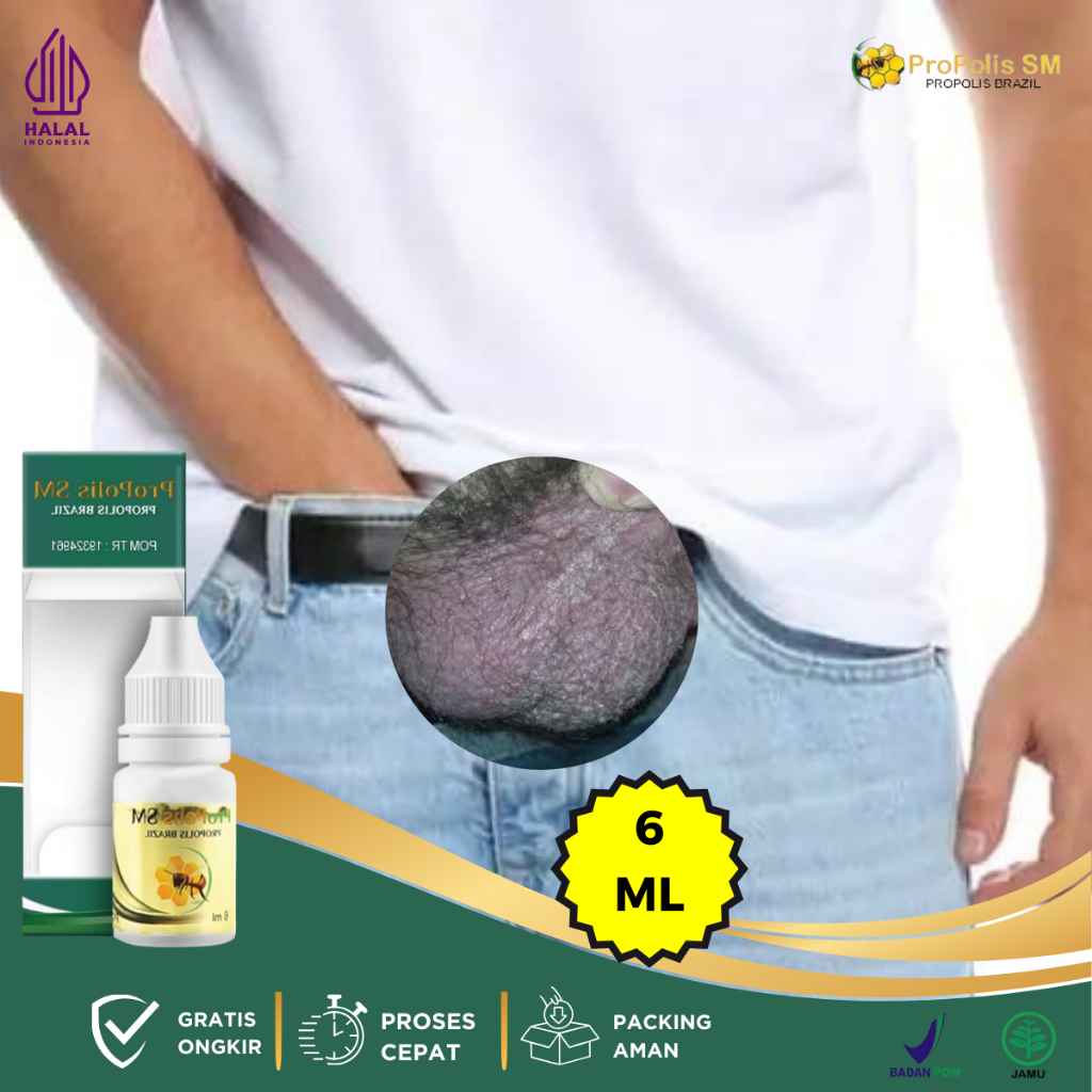 Obat Gatal Buah Zakar Pria, Obat Bentol Di Buah Zakar, Obat Gatal Kemaluan Pria, Obat Herbal Gatal B