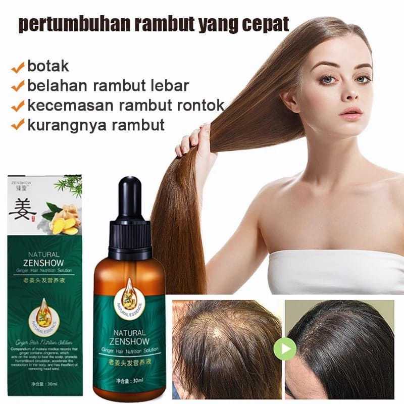 Natural Essence Ginger Hair Solution -,Penumbuh Rambut Solusi Perawatan Rambut Anda (30 ml)