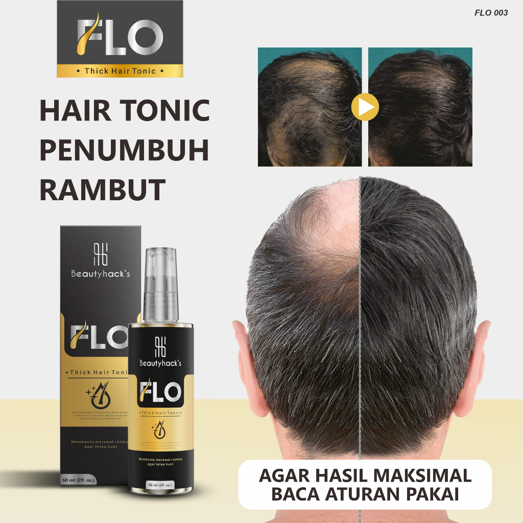 FLO HAIR TONIC-Penumbuh Rambut Botak,Penumbuh Rambut Cepat,Penumbuh Brewok,Penumbuh Rambut Bayi,Penumbuh Kumis Rambut Paling Ampuh dan Cepat,