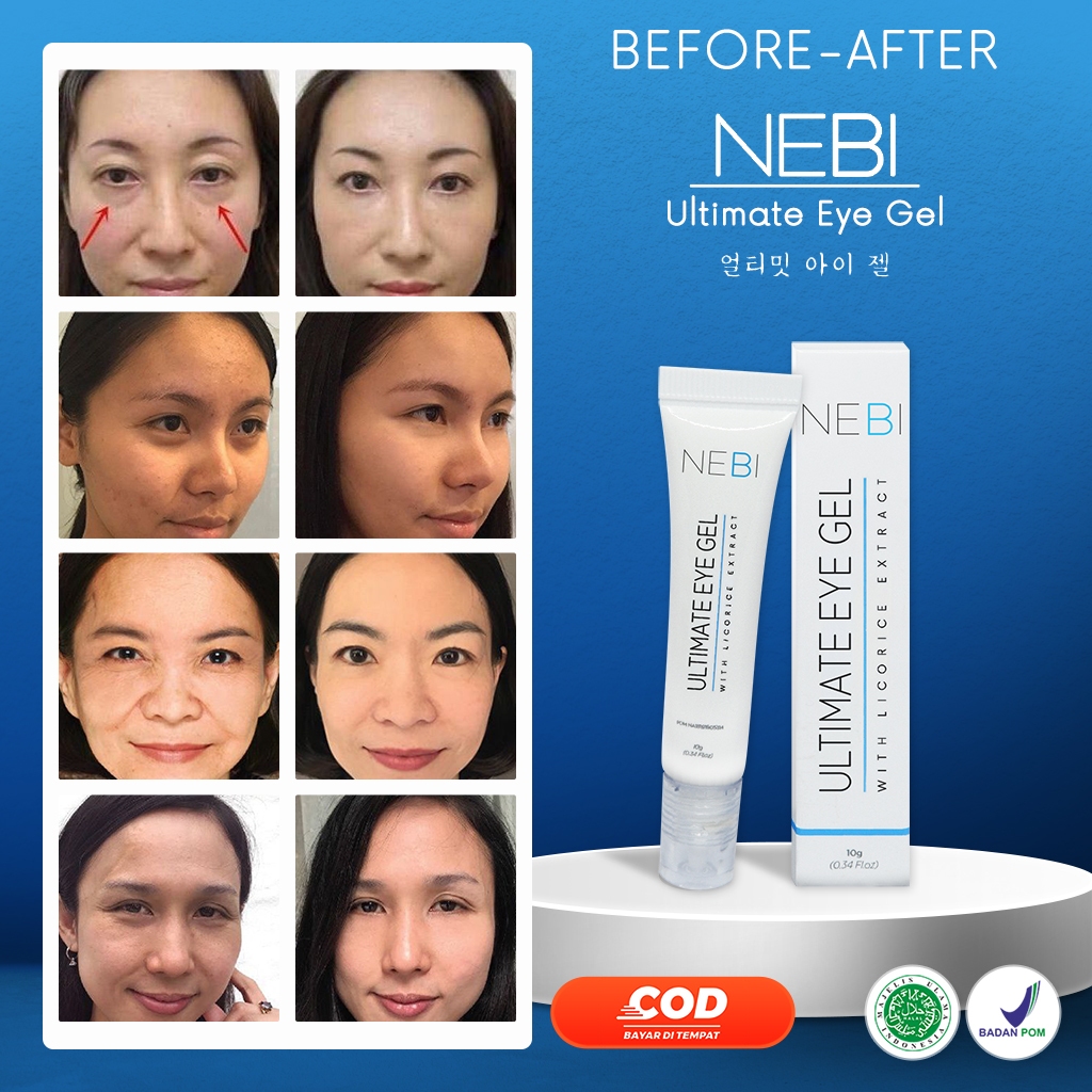 Nebi Ultimate Eye Gel | Kantung Mata | Mata Panda | Kerutan Mata | Kantong Mata | Ultimate Eye Gel b