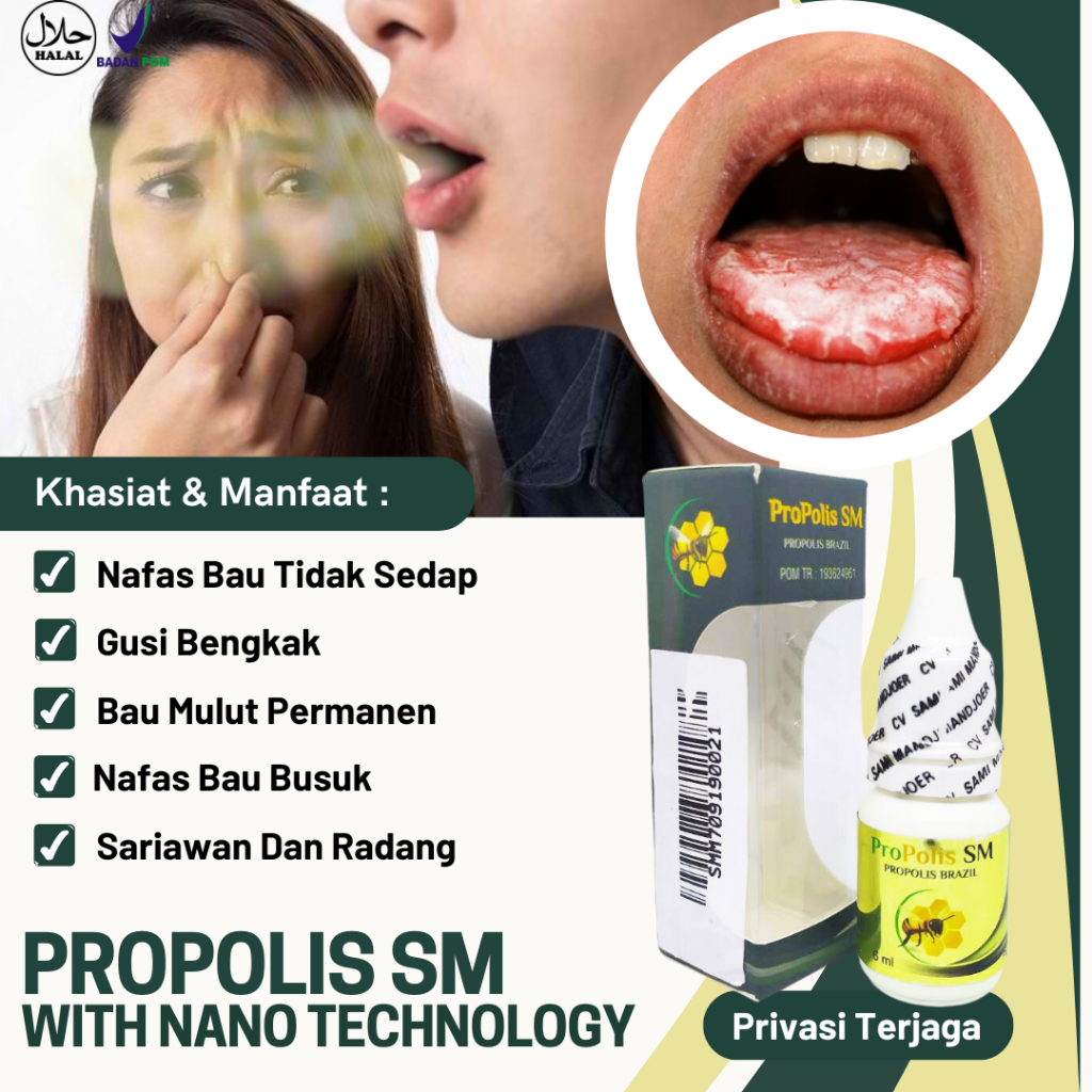 Obat Bau Nafas Bau Mulut Nafas Bau Busuk, Bau Mulut Permanen Mengatasi Permasalahan Bau Mulut