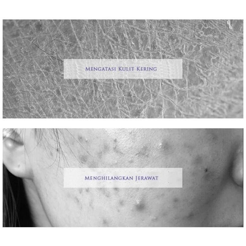 YZKMSKIN Whitening facial cleanser/Sabun cuci muka pembersih wajah & pemutih penghilang jerawat