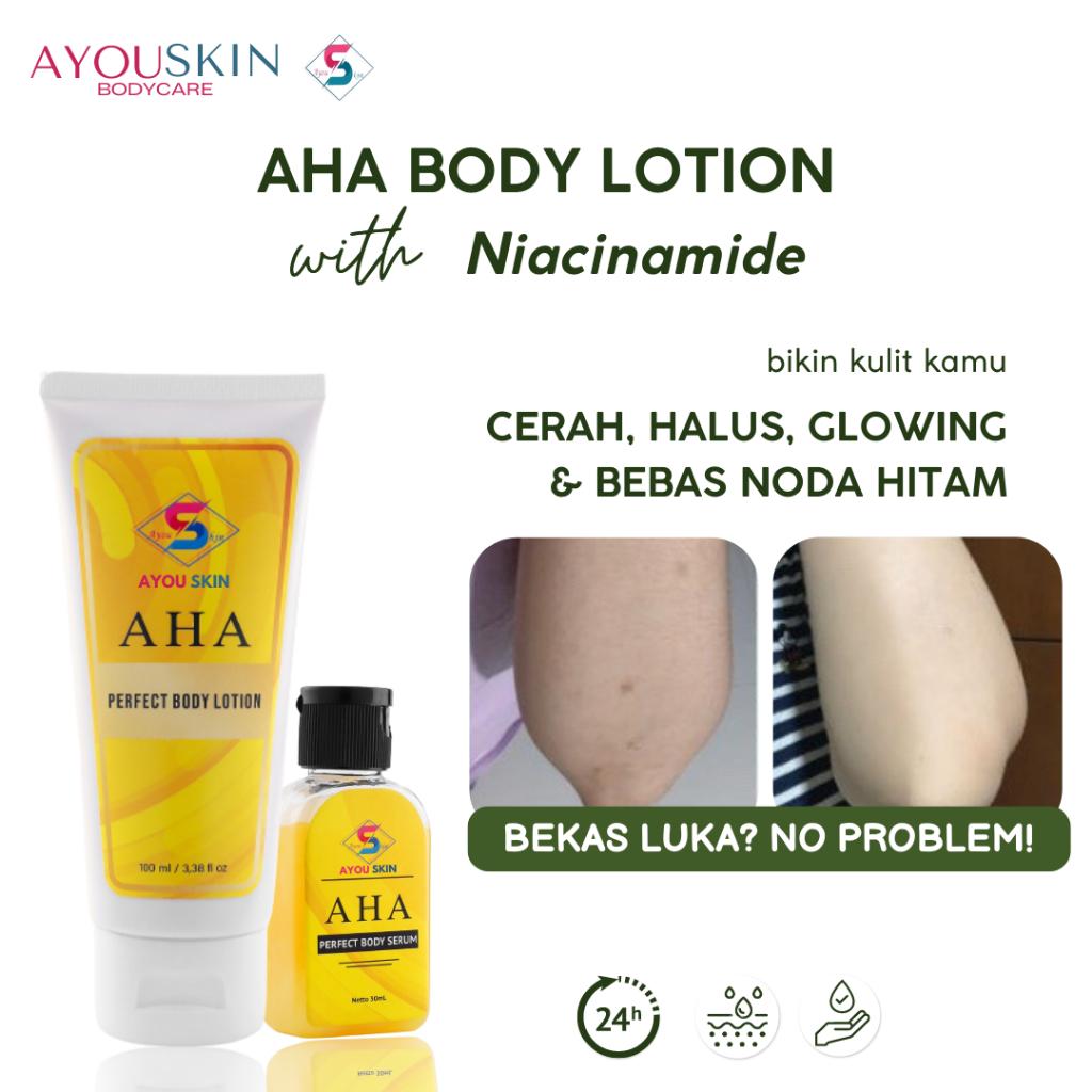 LOTION PEMUTIH BADAN / Penghilang BEKAS LUKA Krim Pemutih Lutut dan Siku, Menghilangkan Noda Hitam H