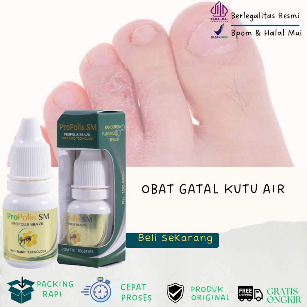 Salep Cair Kutu Air di Sela Jari, Obat Oles Kutu Air di Kaki, Salep Sela Jari Kaki Basah Dan Gatal O