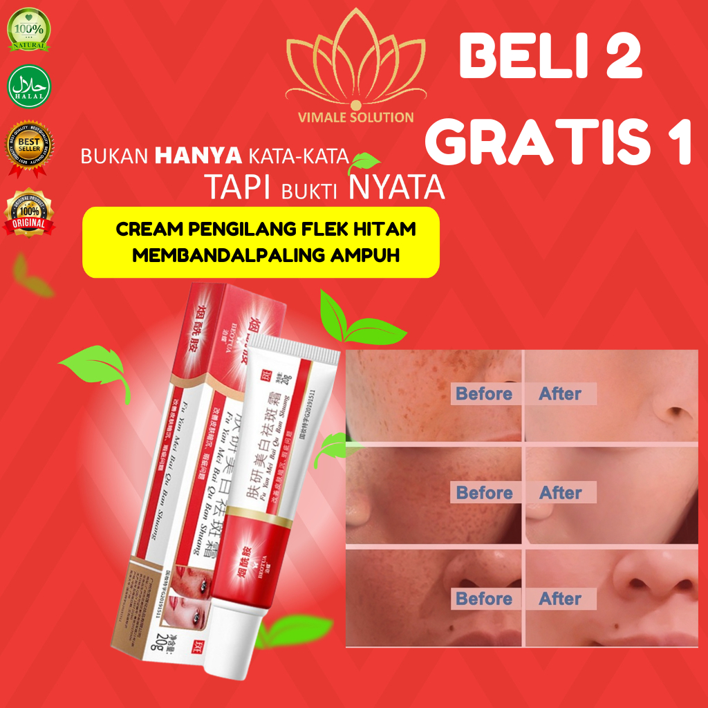 Krim Penghilang Flek Hitam 20g - Salep Obat Fu Yan Mei Bai Qu Ban Shuang - Beo Tua Freckle Cream Dar