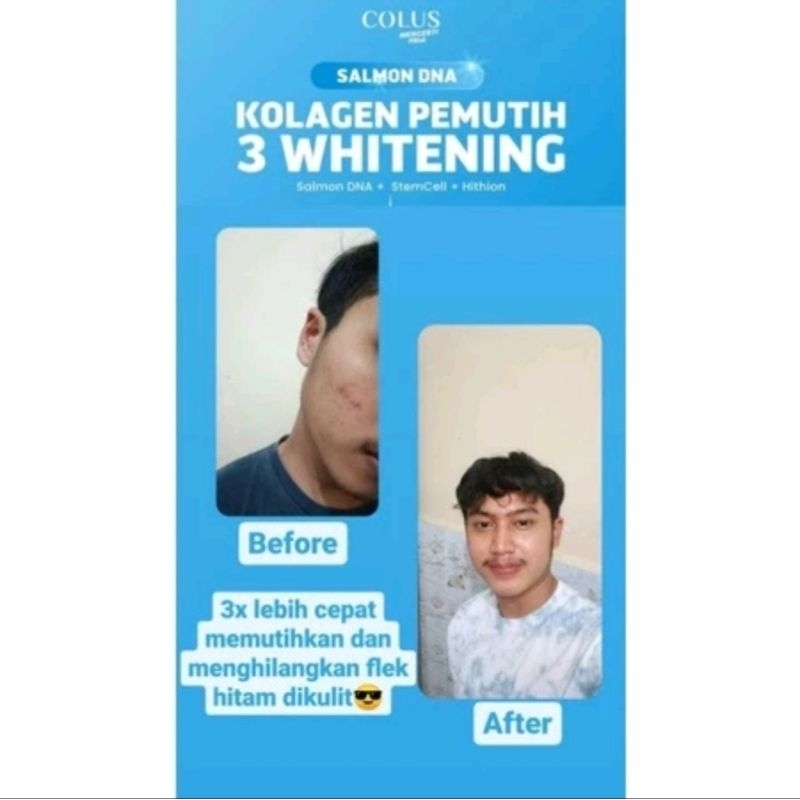 Salmon DNA Collagen pemutih kulit pria