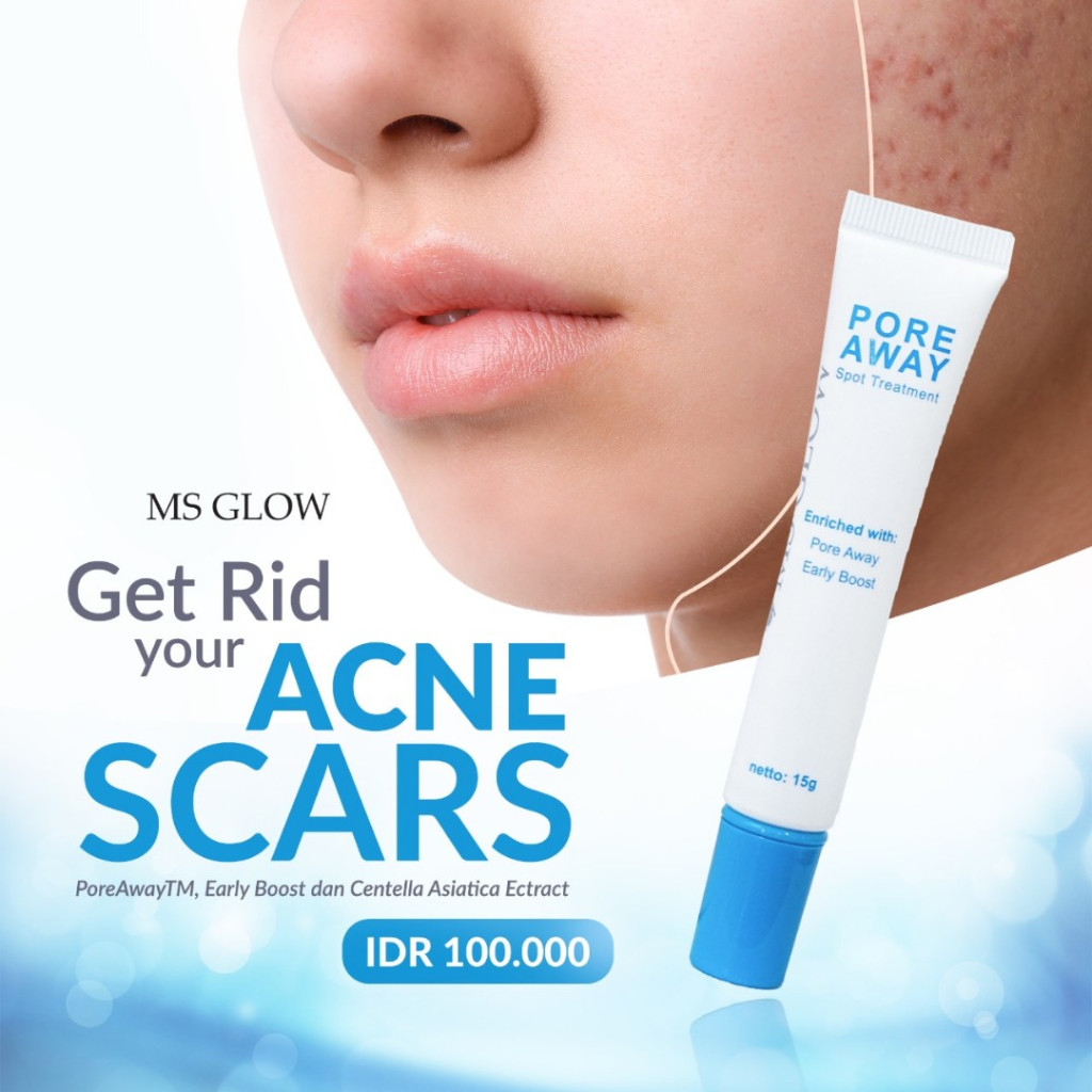 ACNE SPOT MS GLOW / DARK SPOT MS GLOW / PORE AWAY MS GLOW ORIGINAL
