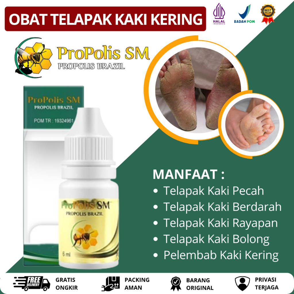Obat Kulit Kering, Obat Kulit Pecah Pecah, Obat Telapak Kaki Pecah dan Berdarah, Obat Kaki Kering da