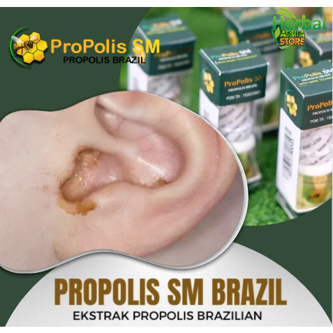 Obat Penghilang Kotoran Telinga | Membersihkan Telinga, Pembersih Telinga, Mengeluarkan Kotoran Teli