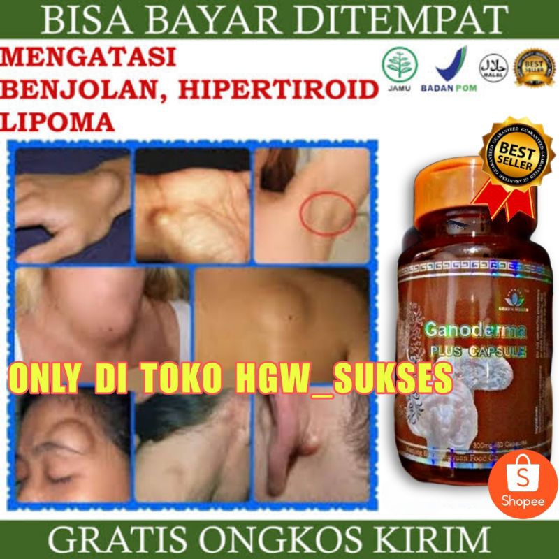 GANODERMA (HERBAL KISTA, KELENJAR TIROID, KANKER, TUMOR, DLL)